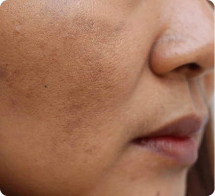 Tu piel luce opaca y cansada, sin importar cuánta agua bebas o cuántas cremas uses.